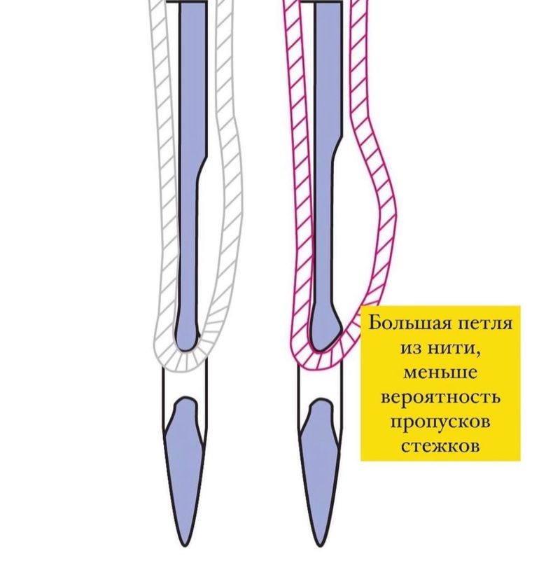 Чем отличаются иглы для трикотажа